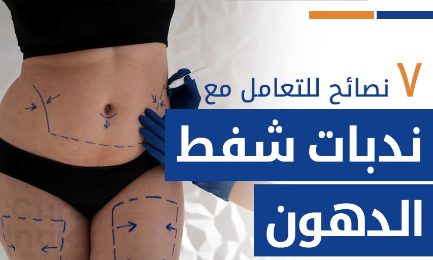 ٧ نصائح مفيدة للتعامل مع ندبات شفط الدهون